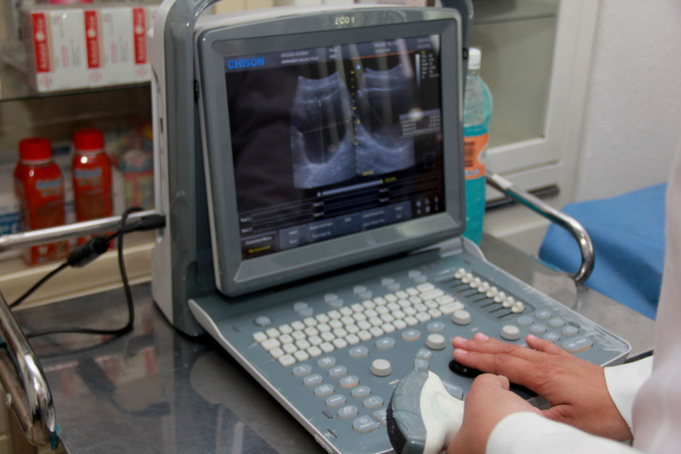 prevenir el cáncer de próstata